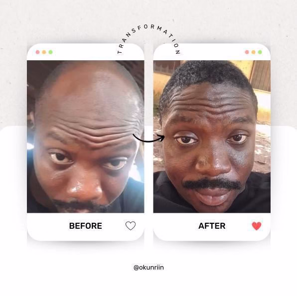 Transformation 1